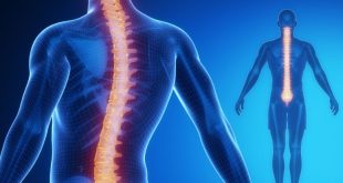 Navigating the Pain of a Herniated Disc: A Comprehensive Guide